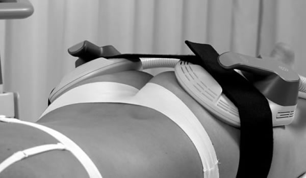 Emsculpt Body Sculpting