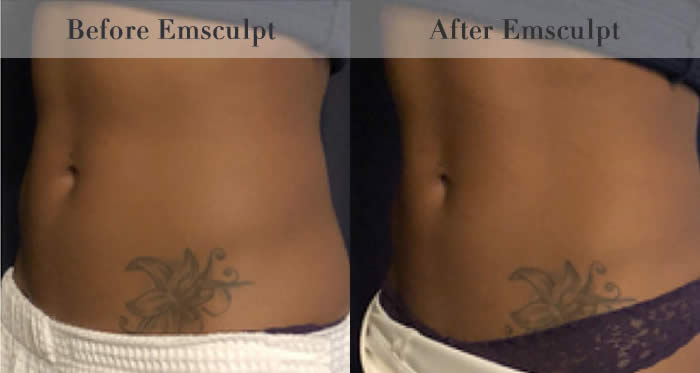 Stomach & Ab Toning