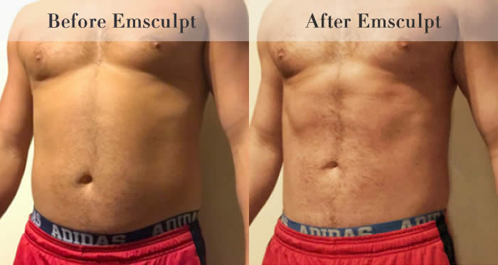 Stomach & Ab Toning