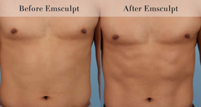 Stomach & Ab Toning