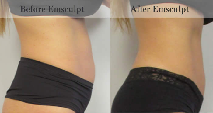 Stomach & Ab Toning