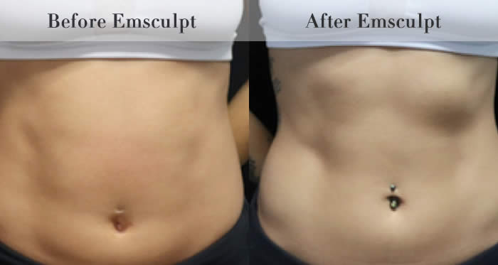 Stomach & Ab Toning
