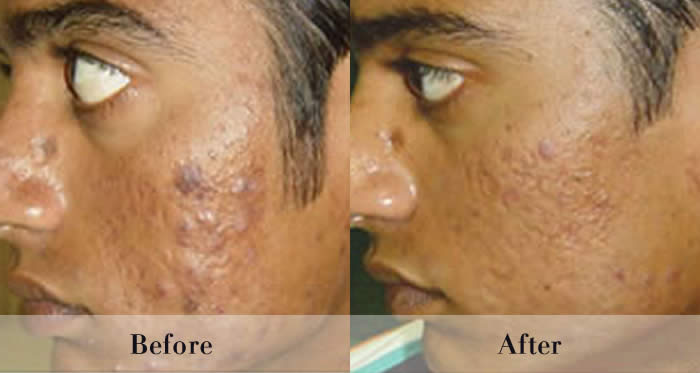 Photo Rejuvenation Before & After