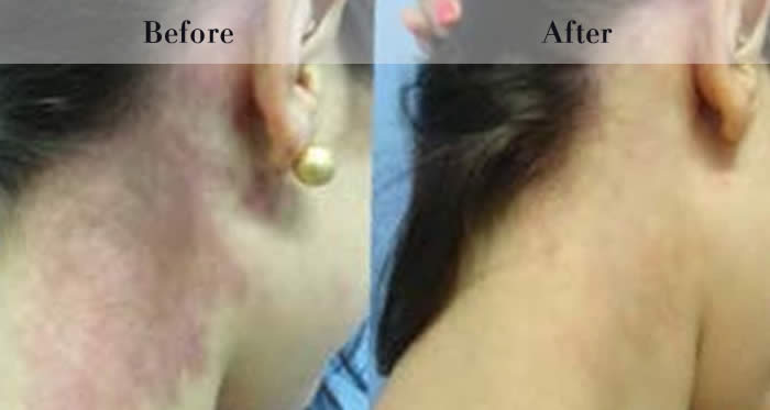 Photo Rejuvenation Before & After