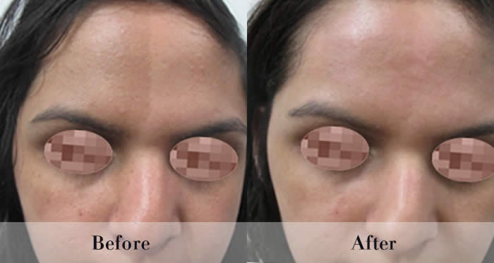 Photo Rejuvenation Before & After