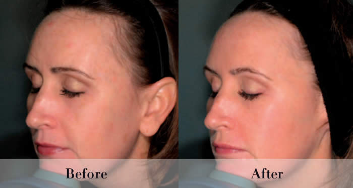 Photo Rejuvenation Before & After