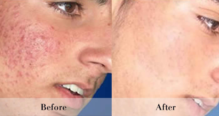 Photo Rejuvenation Before & After