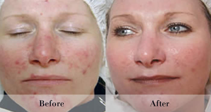 Photo Rejuvenation Before & After