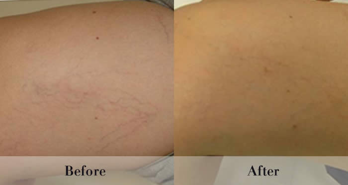 Photo Rejuvenation Before & After