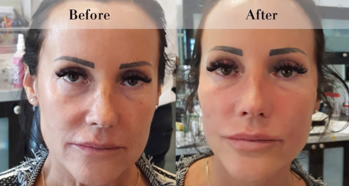 PDO Beauty Threads Before & After