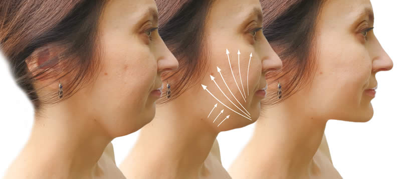 PDO Beauty Threads Before & After