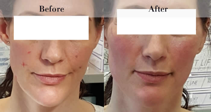 PDO Beauty Threads Before & After