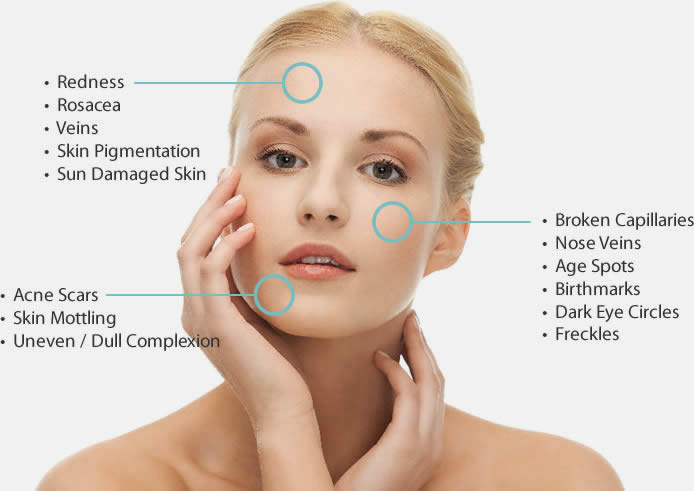 Skin Rejuvenation